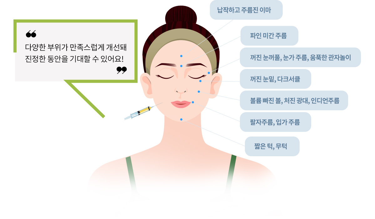 다양한 부위가 만족스럽게 개선돼 진정한 동안을 기대할 수 있어요!(납작하고 주름진 이마, 파인 미간 주름, 꺼진 눈꺼풀, 눈가 주름, 움푹한 관자놀이, 꺼진 눈밑, 다크서클, 볼륨 빠진 볼, 처진 광대, 인디언주름, 팔자주름, 입가 주름, 짧은 턱, 무턱)